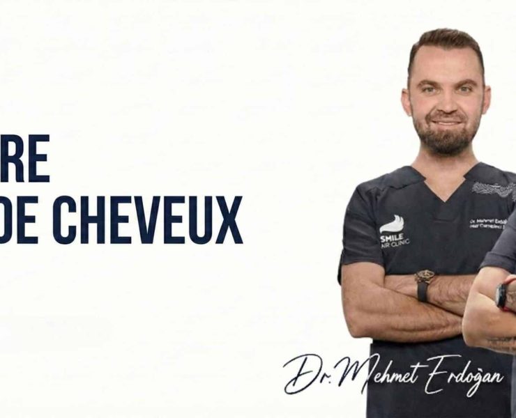 Greffe de cheveux : ce que l’on croit savoir… et ce que les patients découvrent vraiment chez Smile Hair Clinic