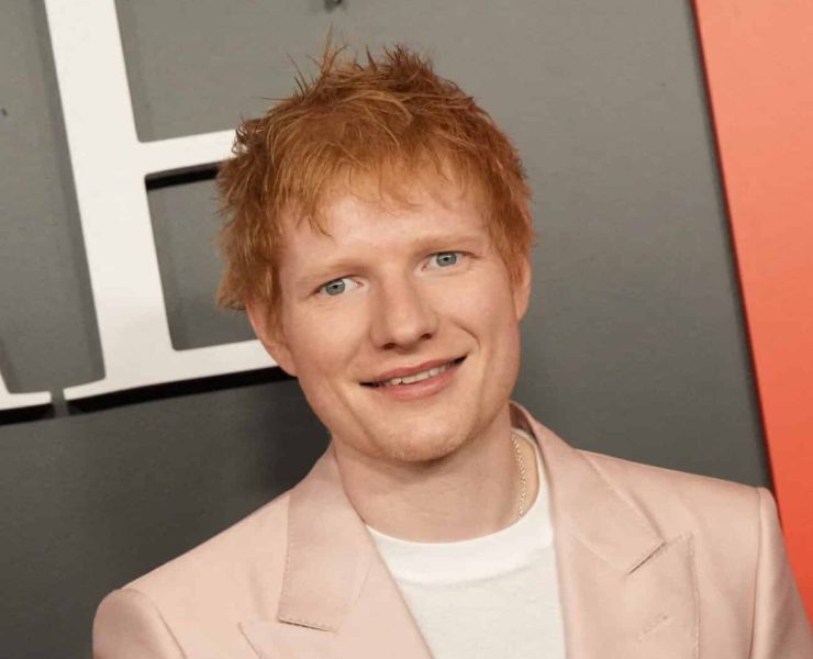 Ed Sheeran dévoile une tête rasée et révèle avoir souffert d'un zona