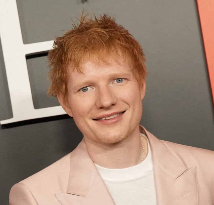 Ed Sheeran dévoile une tête rasée et révèle avoir souffert d'un zona