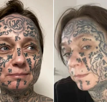 Une femme « forcée » de se faire tatouer le nom de son partenaire 250 fois sur le visage
