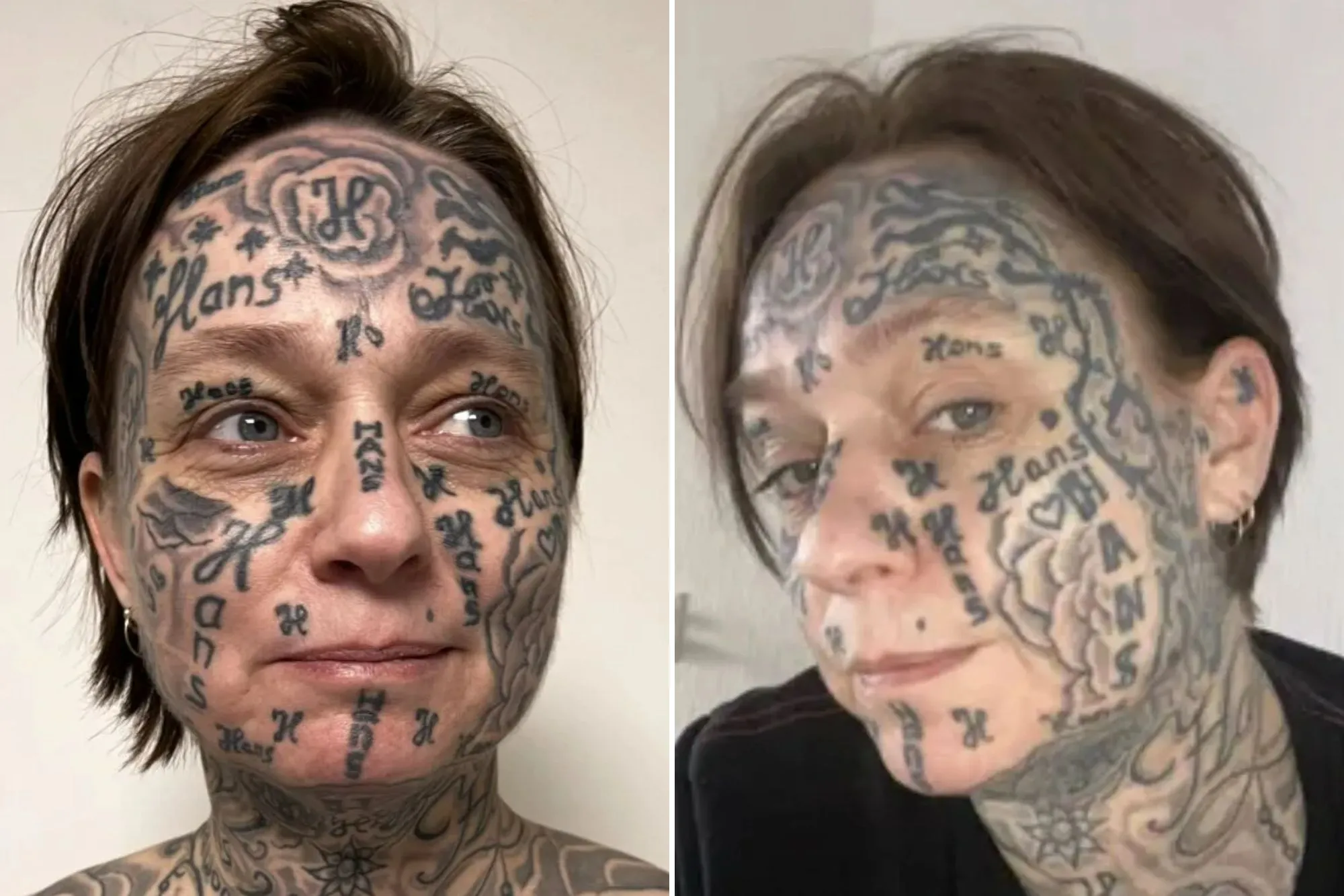Une femme « forcée » de se faire tatouer le nom de son partenaire 250 fois sur le visage
