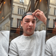 Qui veut épouser mon fils : Kilian, candidat de l’émission, méconnaissable après avoir été passé à tabac à Paris par quatre hommes