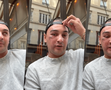 Qui veut épouser mon fils : Kilian, candidat de l’émission, méconnaissable après avoir été passé à tabac à Paris par quatre hommes