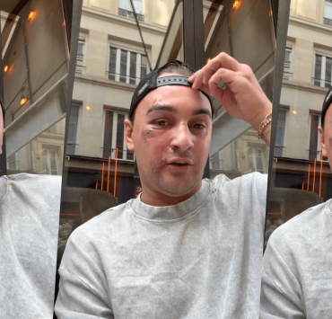 Qui veut épouser mon fils : Kilian, candidat de l’émission, méconnaissable après avoir été passé à tabac à Paris par quatre hommes
