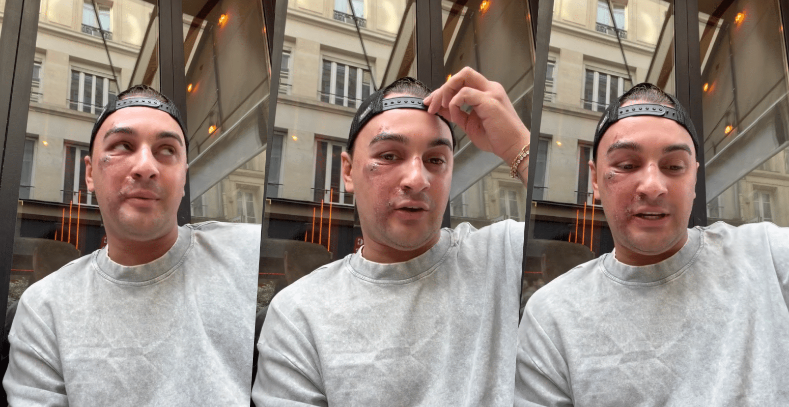 Qui veut épouser mon fils : Kilian, candidat de l’émission, méconnaissable après avoir été passé à tabac à Paris par quatre hommes