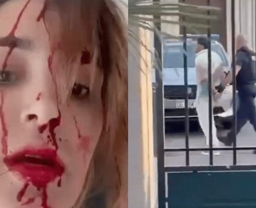 Cannes 2026 : une Miss violemment agressée dans sa chambre d’hôtel, son visage en sang dévoilé, son styliste interpellé